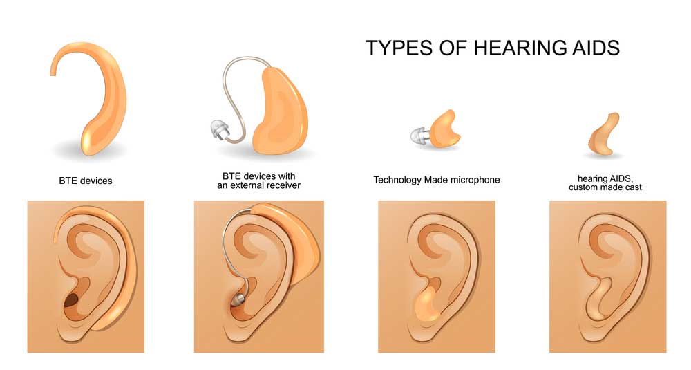 Types of hearing AIDS